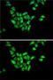 Dynactin Subunit 1 antibody, GTX54021, GeneTex, Immunocytochemistry image 