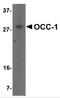 Putative overexpressed in colon carcinoma 1 protein antibody, 4997, ProSci, Western Blot image 
