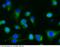C-Type Lectin Domain Containing 7A antibody, 50233-R010, Sino Biological, Immunohistochemistry paraffin image 
