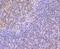 CD74 Molecule antibody, NBP2-66762, Novus Biologicals, Immunohistochemistry paraffin image 