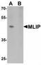Muscular LMNA-interacting protein antibody, TA320068, Origene, Western Blot image 