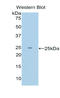 Lysine-specific demethylase 4C antibody, LS-C300346, Lifespan Biosciences, Western Blot image 