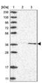 Cyclin-dependent kinase 20 antibody, PA5-55593, Invitrogen Antibodies, Western Blot image 