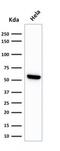 Heat Shock Protein Family D (Hsp60) Member 1 antibody, GTX34785, GeneTex, Western Blot image 