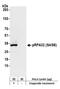 Replication Protein A2 antibody, A700-009, Bethyl Labs, Western Blot image 