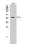 Mitogen-Activated Protein Kinase Kinase 1 antibody, STJ94078, St John