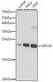 Kinetochore protein Spc24 antibody, A07723, Boster Biological Technology, Western Blot image 