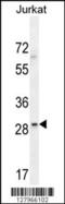 Leucine Rich Repeat Containing 25 antibody, 55-261, ProSci, Western Blot image 