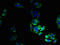 Transient Receptor Potential Cation Channel Subfamily M Member 2 antibody, LS-C395825, Lifespan Biosciences, Immunofluorescence image 