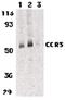 C-C Motif Chemokine Receptor 3 antibody, PA5-19859, Invitrogen Antibodies, Western Blot image 