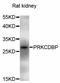 Protein kinase C delta-binding protein antibody, STJ27091, St John
