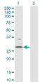 Hydroxysteroid 11-Beta Dehydrogenase 1 antibody, LS-C197461, Lifespan Biosciences, Western Blot image 