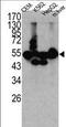 ACBP antibody, LS-C100516, Lifespan Biosciences, Western Blot image 