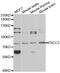 ERCC Excision Repair 3, TFIIH Core Complex Helicase Subunit antibody, MBS127797, MyBioSource, Western Blot image 