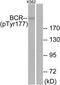 BCR Activator Of RhoGEF And GTPase antibody, TA313502, Origene, Western Blot image 