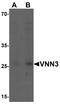 Vanin 3 antibody, A10601, Boster Biological Technology, Western Blot image 