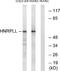 Heterogeneous Nuclear Ribonucleoprotein L Like antibody, A30717, Boster Biological Technology, Western Blot image 