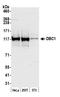 Cell cycle and apoptosis regulator protein 2 antibody, A300-433A, Bethyl Labs, Western Blot image 