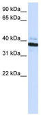 2'-5'-Oligoadenylate Synthetase 1 antibody, TA339210, Origene, Western Blot image 