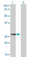 Homeobox A7 antibody, LS-C197434, Lifespan Biosciences, Western Blot image 