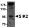 Salt Inducible Kinase 2 antibody, orb75608, Biorbyt, Western Blot image 