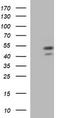 Parvin Beta antibody, TA505677S, Origene, Western Blot image 