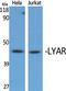 Ly1 Antibody Reactive antibody, A09986, Boster Biological Technology, Western Blot image 