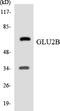 Protein Kinase C Substrate 80K-H antibody, LS-C291998, Lifespan Biosciences, Western Blot image 
