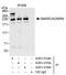 SWI/SNF Related, Matrix Associated, Actin Dependent Regulator Of Chromatin, Subfamily A, Member 2 antibody, A301-014A, Bethyl Labs, Immunoprecipitation image 