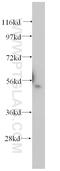 Aspartyl Aminopeptidase antibody, 15016-1-AP, Proteintech Group, Western Blot image 