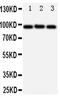 ATP Binding Cassette Subfamily B Member 6 (Langereis Blood Group) antibody, PA5-78693, Invitrogen Antibodies, Western Blot image 