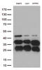 Cathepsin L1 antibody, LS-C793142, Lifespan Biosciences, Western Blot image 
