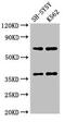 CTSH antibody, CSB-PA006191LA01HU, Cusabio, Western Blot image 
