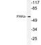 Alpha-PAK antibody, LS-C176642, Lifespan Biosciences, Western Blot image 