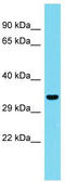 G-Patch Domain Containing 11 antibody, TA334823, Origene, Western Blot image 