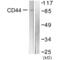 CD44, variant 6 antibody, SPC-1271D-RPE, StressMarq, Western Blot image 
