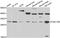 ATP Synthase C Subunit Lysine N-Methyltransferase antibody, A17438, Boster Biological Technology, Western Blot image 