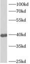Ankyrin repeat domain-containing protein 2 antibody, FNab00410, FineTest, Western Blot image 