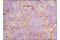 Prolyl 4-Hydroxylase Subunit Beta antibody, 3501P, Cell Signaling Technology, Immunohistochemistry paraffin image 