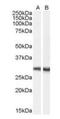 Doublecortin Domain Containing 2 antibody, orb19352, Biorbyt, Western Blot image 