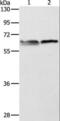 5'-Aminolevulinate Synthase 2 antibody, LS-C401211, Lifespan Biosciences, Western Blot image 