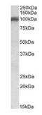Glutamate Ionotropic Receptor AMPA Type Subunit 1 antibody, orb22516, Biorbyt, Western Blot image 