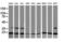RAB30, Member RAS Oncogene Family antibody, LS-C787554, Lifespan Biosciences, Western Blot image 