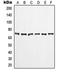 LIM domain kinase 1 antibody, orb214191, Biorbyt, Western Blot image 