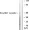 Coagulation Factor II Thrombin Receptor antibody, LS-C118592, Lifespan Biosciences, Western Blot image 