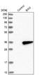 Bridging Integrator 3 antibody, NBP1-85988, Novus Biologicals, Western Blot image 