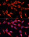Pyruvate Dehydrogenase E1 Alpha 2 Subunit antibody, 23-990, ProSci, Immunofluorescence image 