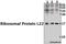 Ribosomal Protein L22 antibody, A04499, Boster Biological Technology, Western Blot image 