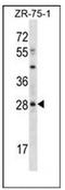 Msh Homeobox 2 antibody, AP52762PU-N, Origene, Western Blot image 
