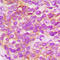 Fibroblast Growth Factor Receptor 1 antibody, LS-C358997, Lifespan Biosciences, Immunohistochemistry paraffin image 